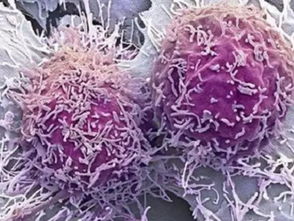 从图看显微镜下的各类癌细胞 画风完全不一样